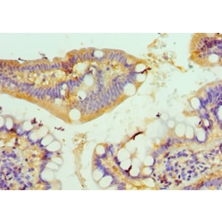 Immunohistochemistry - CSRP2BP Polyclonal Antibody from Signalway Antibody (42686) - Antibodies.com