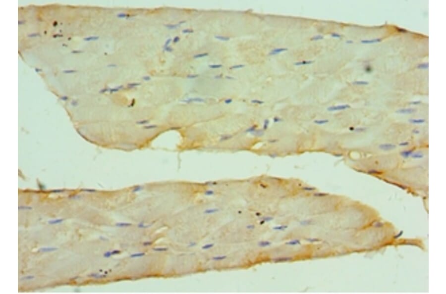 Immunohistochemistry - CSRP2BP Polyclonal Antibody from Signalway Antibody (42686) - Antibodies.com