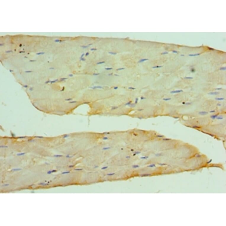 Immunohistochemistry - CSRP2BP Polyclonal Antibody from Signalway Antibody (42686) - Antibodies.com