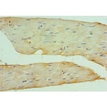 Immunohistochemistry - CSRP2BP Polyclonal Antibody from Signalway Antibody (42686) - Antibodies.com