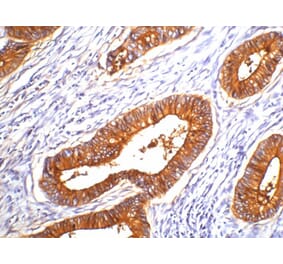 Carcinoembryonic Antigen (CEA) Mouse Monoclonal Antibody from Signalway Antibody (38016) - Antibodies.com