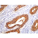 Carcinoembryonic Antigen (CEA) Mouse Monoclonal Antibody from Signalway Antibody (38016) - Antibodies.com