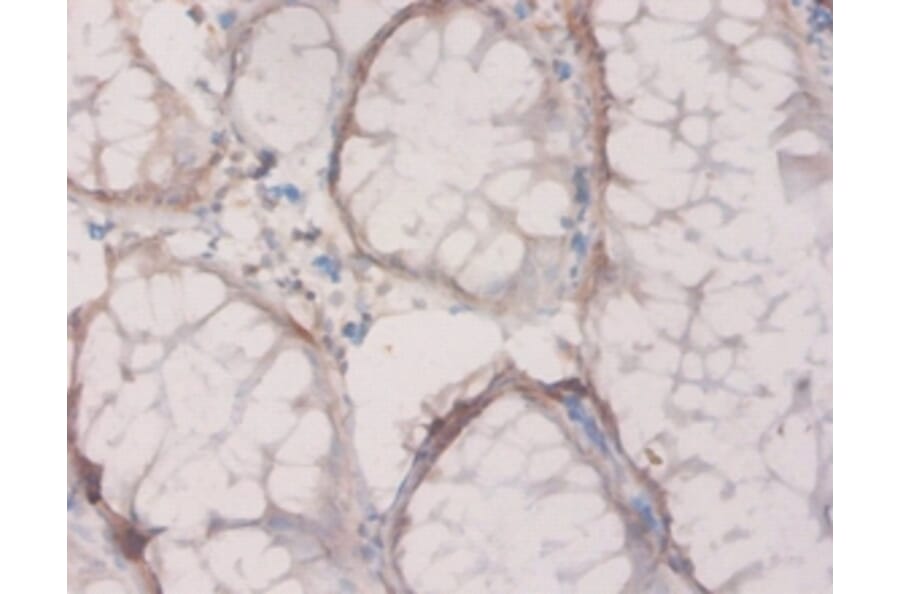 Immunohistochemistry - 4-hydroxyphenylpyruvate dioxygenase Polyclonal Antibody from Signalway Antibody (42213)