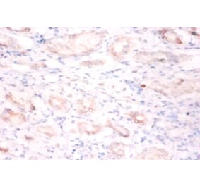 Immunohistochemistry - BTB/POZ domain-containing protein 2 Polyclonal Antibody from Signalway Antibody (42422)