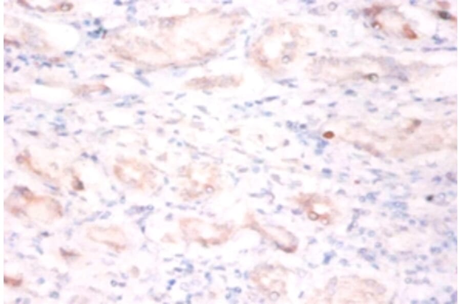 Immunohistochemistry - BTB/POZ domain-containing protein 2 Polyclonal Antibody from Signalway Antibody (42422)