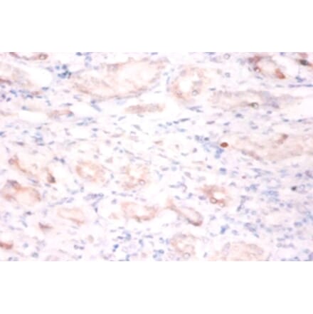 Immunohistochemistry - BTB/POZ domain-containing protein 2 Polyclonal Antibody from Signalway Antibody (42422)