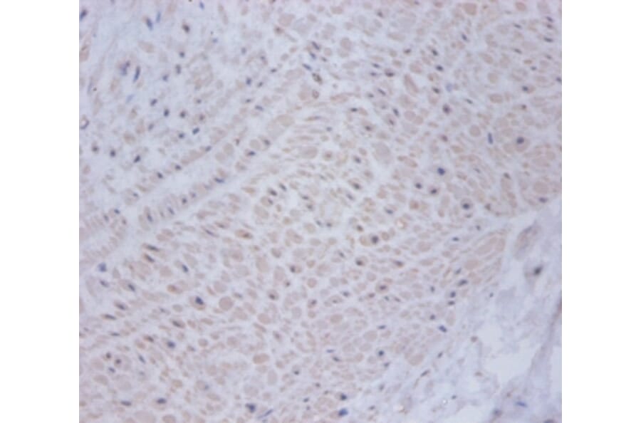 Immunohistochemistry - Cysteine and glycine-rich protein 2 Polyclonal Antibody from Signalway Antibody (42470)
