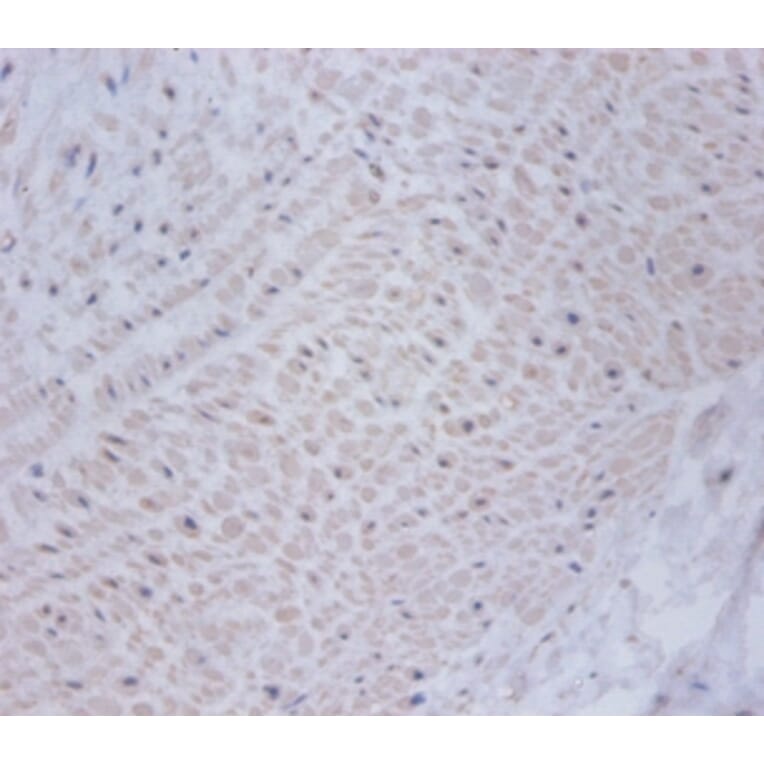 Immunohistochemistry - Cysteine and glycine-rich protein 2 Polyclonal Antibody from Signalway Antibody (42470)