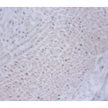 Immunohistochemistry - Cysteine and glycine-rich protein 2 Polyclonal Antibody from Signalway Antibody (42470)