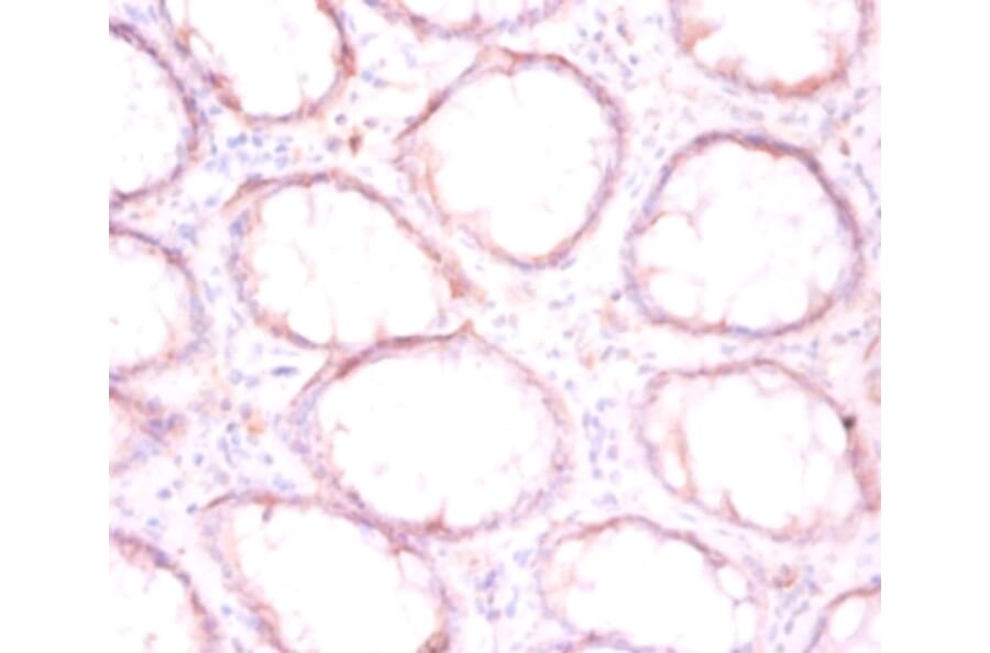 Immunohistochemistry - Protein disulfide-isomerase Polyclonal Antibody from Signalway Antibody - Antibodies.com