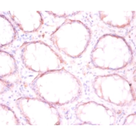 Immunohistochemistry - Protein disulfide-isomerase Polyclonal Antibody from Signalway Antibody - Antibodies.com