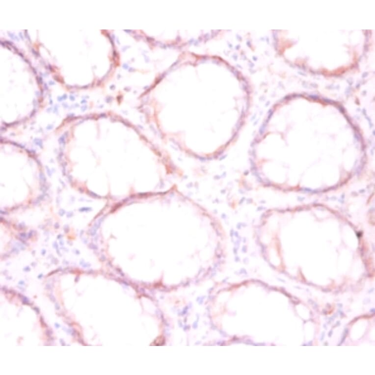 Immunohistochemistry - Protein disulfide-isomerase Polyclonal Antibody from Signalway Antibody - Antibodies.com