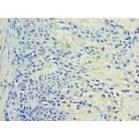 Immunohistochemistry - Ras-related protein Rab-11A Polyclonal Antibody from Signalway Antibody - Antibodies.com