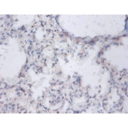 Immunohistochemistry - Sulfate anion transporter 1 Polyclonal Antibody from Signalway Antibody - Antibodies.com