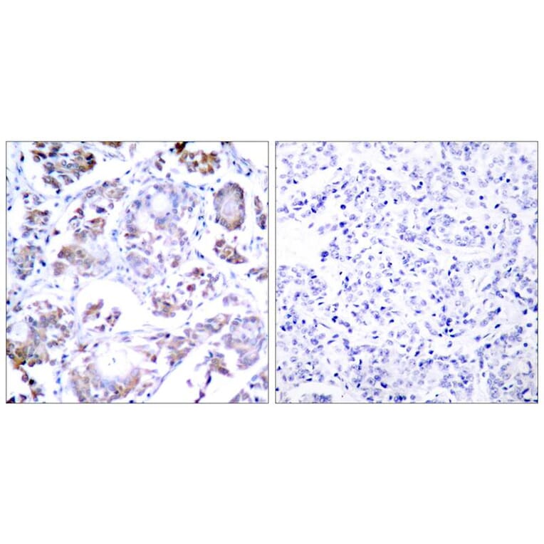 Immunohistochemistry - NFkB-p65 (Ab-254) Antibody from Signalway Antibody (21010) - Antibodies.com