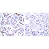 Immunohistochemistry - NFkB-p65 (Ab-254) Antibody from Signalway Antibody (21010) - Antibodies.com