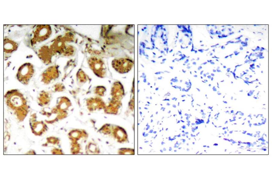 Immunohistochemistry - NFkB-p65 (Ab-505) Antibody from Signalway Antibody (21178) - Antibodies.com