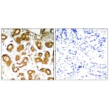 Immunohistochemistry - NFkB-p65 (Ab-505) Antibody from Signalway Antibody (21178) - Antibodies.com