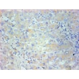 Immunohistochemistry - Nestin Monoclonal Antibody from Signalway Antibody (42024) - Antibodies.com