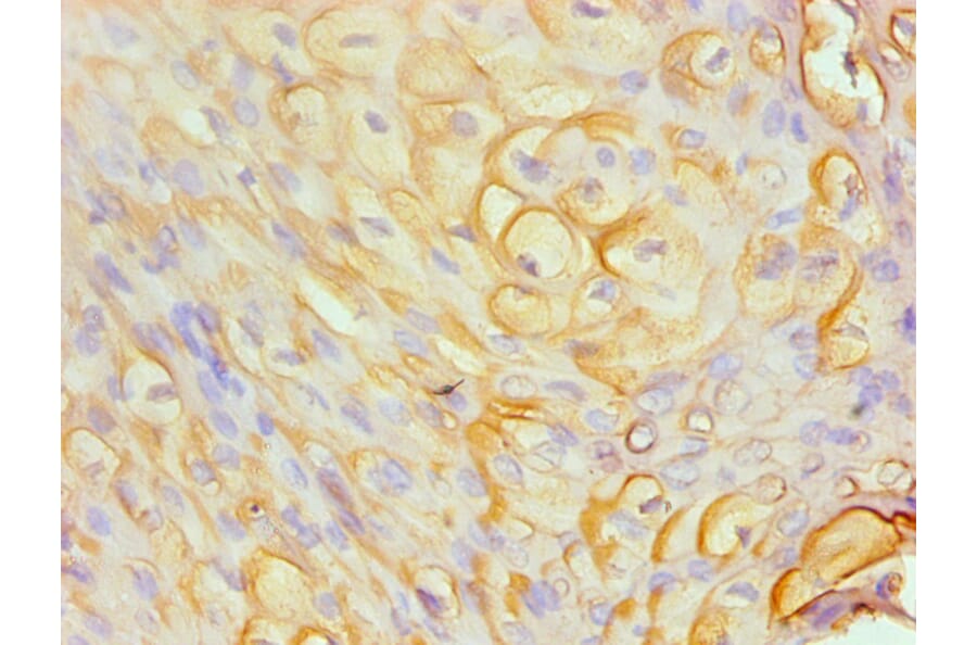 Immunohistochemistry - S100A8 Monoclonal Antibody from Signalway Antibody (42026) - Antibodies.com