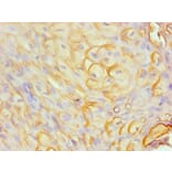 Immunohistochemistry - S100A8 Monoclonal Antibody from Signalway Antibody (42026) - Antibodies.com