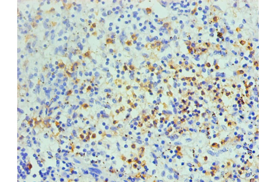 Immunohistochemistry - S100A8 Monoclonal Antibody from Signalway Antibody (42026) - Antibodies.com