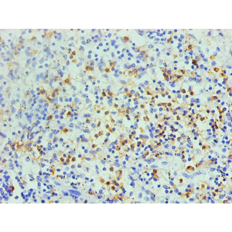 Immunohistochemistry - S100A8 Monoclonal Antibody from Signalway Antibody (42026) - Antibodies.com