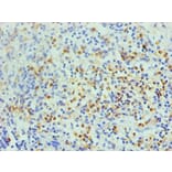 Immunohistochemistry - S100A8 Monoclonal Antibody from Signalway Antibody (42026) - Antibodies.com