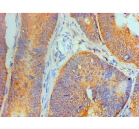 Immunohistochemistry - IL1F10 Monoclonal Antibody from Signalway Antibody (42049) - Antibodies.com