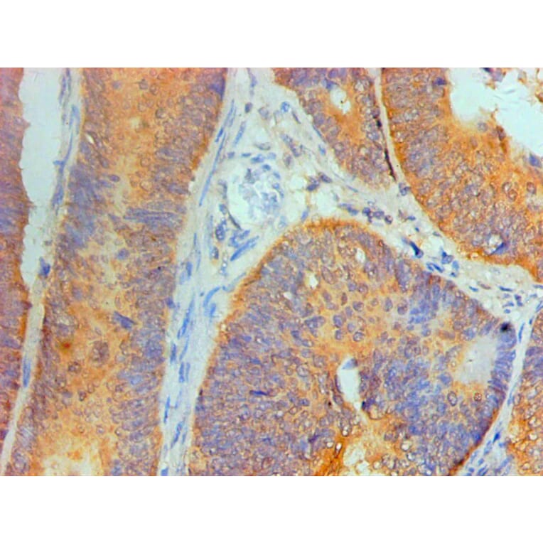 Immunohistochemistry - IL1F10 Monoclonal Antibody from Signalway Antibody (42049) - Antibodies.com