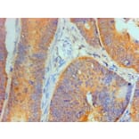Immunohistochemistry - IL1F10 Monoclonal Antibody from Signalway Antibody (42049) - Antibodies.com