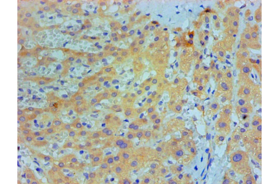 Immunohistochemistry - IL1F10 Monoclonal Antibody from Signalway Antibody (42049) - Antibodies.com