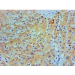 Immunohistochemistry - IL1F10 Monoclonal Antibody from Signalway Antibody (42049) - Antibodies.com