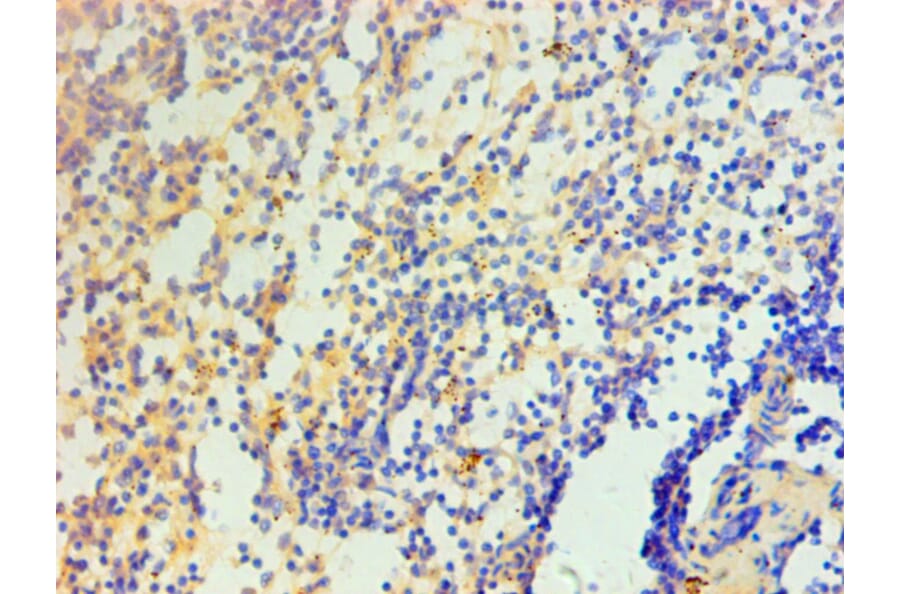 Immunohistochemistry - IL1F10 Monoclonal Antibody from Signalway Antibody (42049) - Antibodies.com