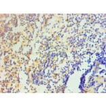 Immunohistochemistry - IL1F10 Monoclonal Antibody from Signalway Antibody (42049) - Antibodies.com