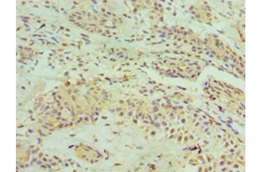 Immunohistochemistry - HNRNPM Polyclonal Antibody from Signalway Antibody (42209) - Antibodies.com