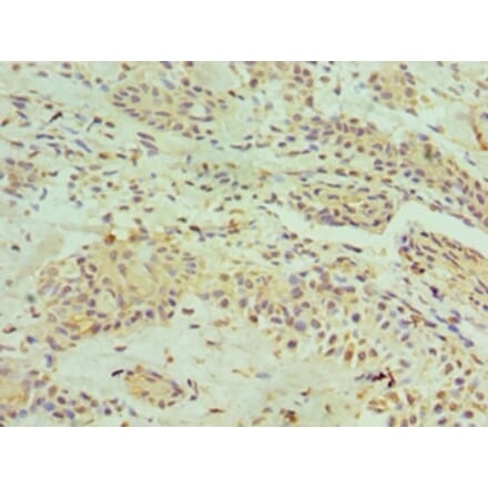 Immunohistochemistry - HNRNPM Polyclonal Antibody from Signalway Antibody (42209) - Antibodies.com
