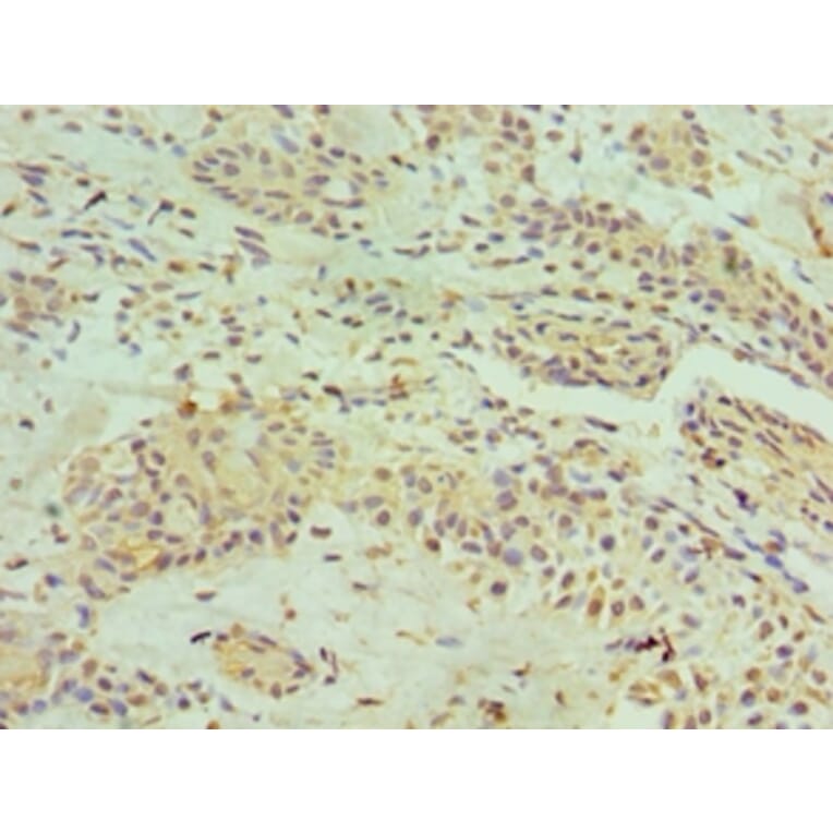 Immunohistochemistry - HNRNPM Polyclonal Antibody from Signalway Antibody (42209) - Antibodies.com