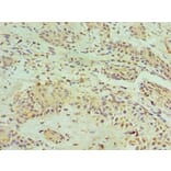 Immunohistochemistry - HNRNPM Polyclonal Antibody from Signalway Antibody (42209) - Antibodies.com