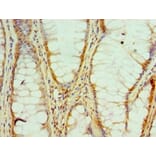 Immunohistochemistry - HNRNPM Polyclonal Antibody from Signalway Antibody (42209) - Antibodies.com