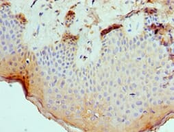 Immunohistochemical analysis of paraffin-embedded human skin using #42326 at dilution of 1: 100.