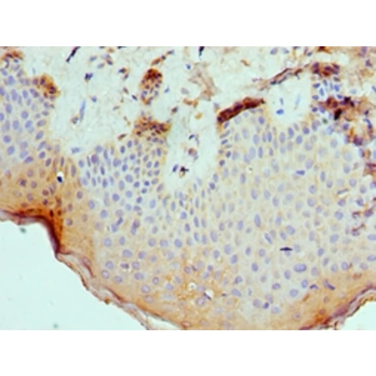 Immunohistochemistry - SLURP1 Polyclonal Antibody from Signalway Antibody (42326) - Antibodies.com