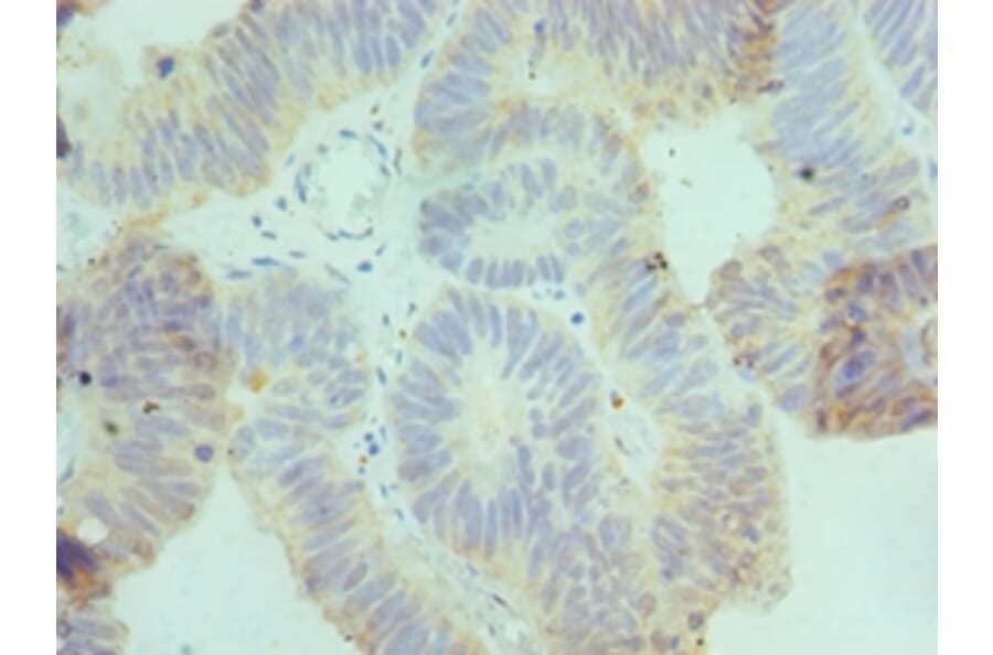 Immunohistochemistry - CSRNP1 Polyclonal Antibody from Signalway Antibody (42663) - Antibodies.com