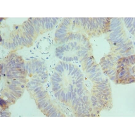 Immunohistochemistry - CSRNP1 Polyclonal Antibody from Signalway Antibody (42663) - Antibodies.com