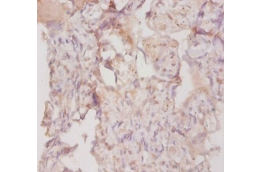 Immunohistochemistry - Collagen alpha-3 (IV) chain Polyclonal Antibody from Signalway Antibody - Antibodies.com