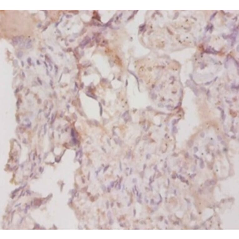 Immunohistochemistry - Collagen alpha-3 (IV) chain Polyclonal Antibody from Signalway Antibody - Antibodies.com