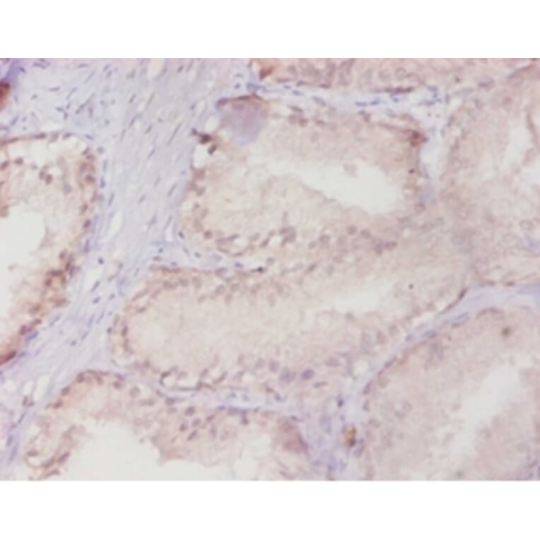 Immunohistochemistry - Ras-related protein Rab-10 Polyclonal Antibody from Signalway Antibody - Antibodies.com