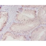 Immunohistochemistry - Ras-related protein Rab-10 Polyclonal Antibody from Signalway Antibody - Antibodies.com