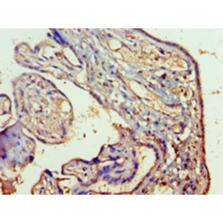 Immunohistochemistry - Ras-related protein Rab-5A Polyclonal Antibody from Signalway Antibody - Antibodies.com