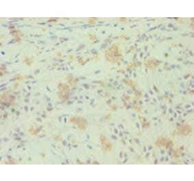 Immunohistochemistry - Nuclear receptor ROR-gamma Polyclonal Antibody from Signalway Antibody - Antibodies.com
